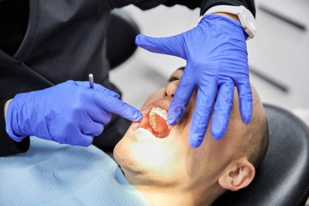 Best Emergency Root Canal Treatment in Wakefield, VA